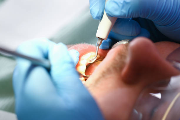 Best Emergency Dental Care for Sports Injuries in Hope, AR